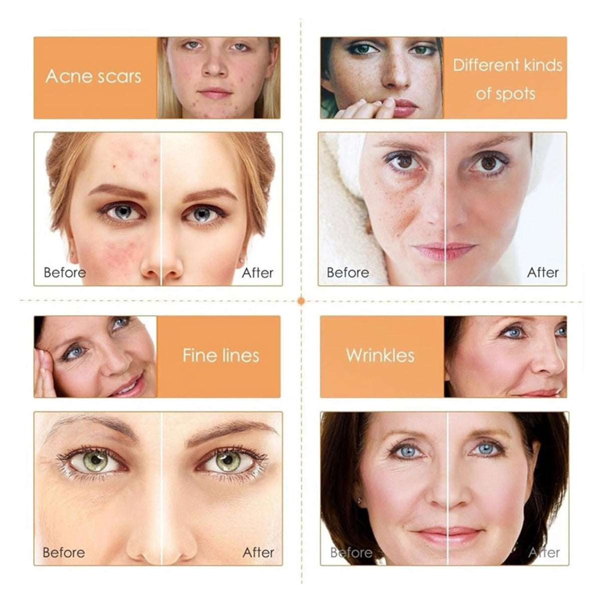 Vitamin C Hautpflege Set für Frauen Teenager-Mädchen Skin Care Set Gesichtswasser Creme Maske Serum 5-tlg Gesichtspflege Set als Geschenk