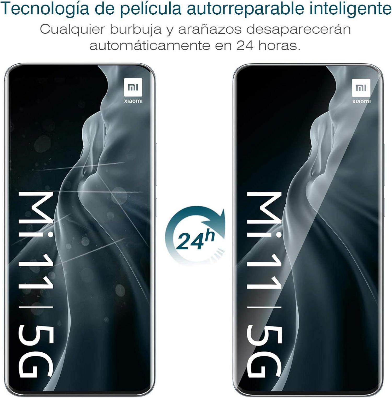 Displayschutz Xiaomi Mi 11 Pro 3 Stück TPU HD klar weich transparent