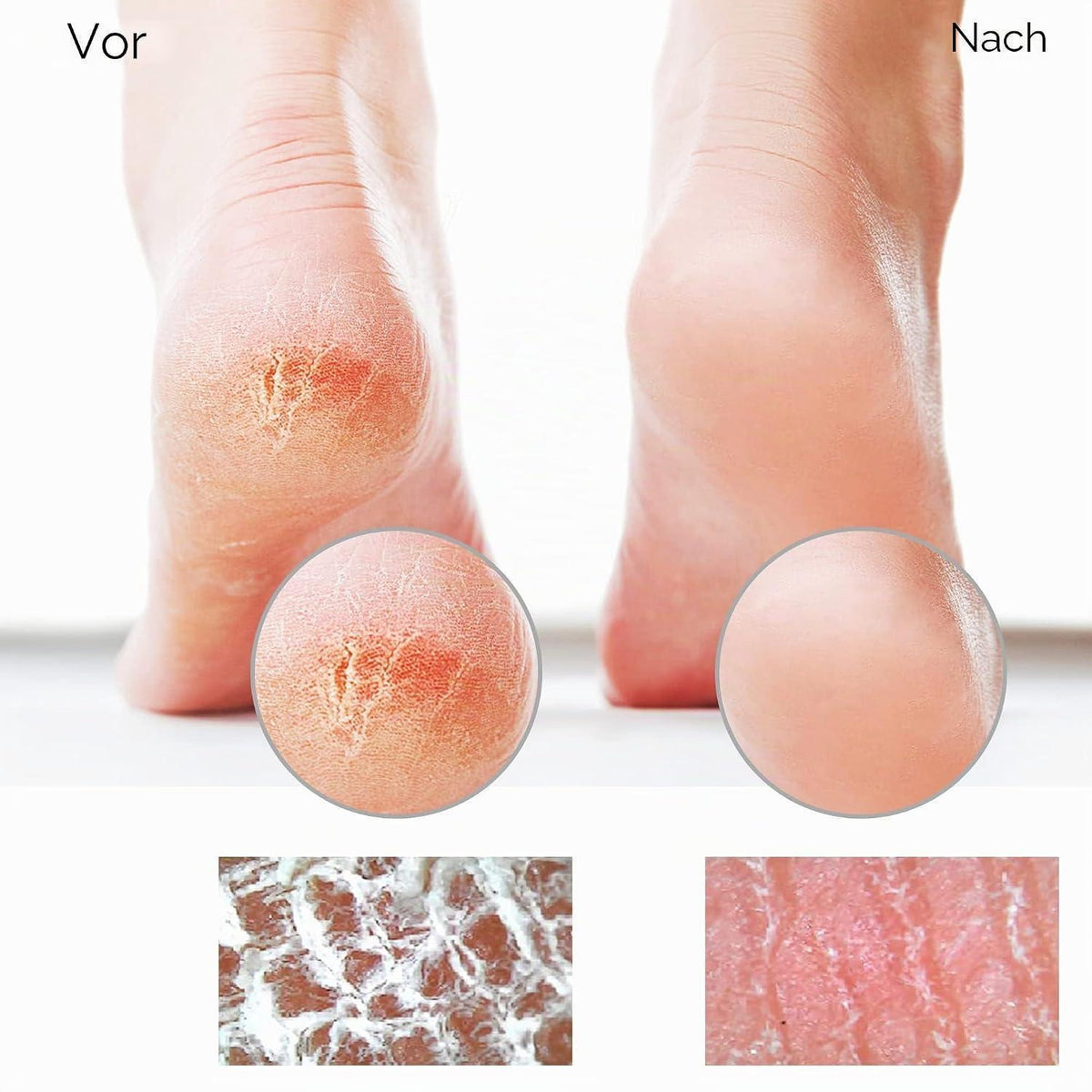Nano Glas Hornhautentferner – Für Samtweiche Füße & Professionelle Fußpflege