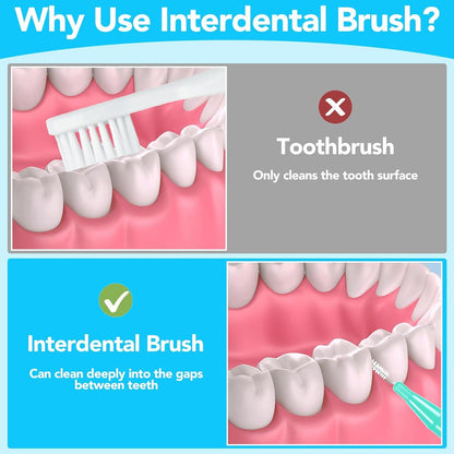 50 Stück Interdentalbürsten Zahnreinigung Zwischenräume Mundgesundheit