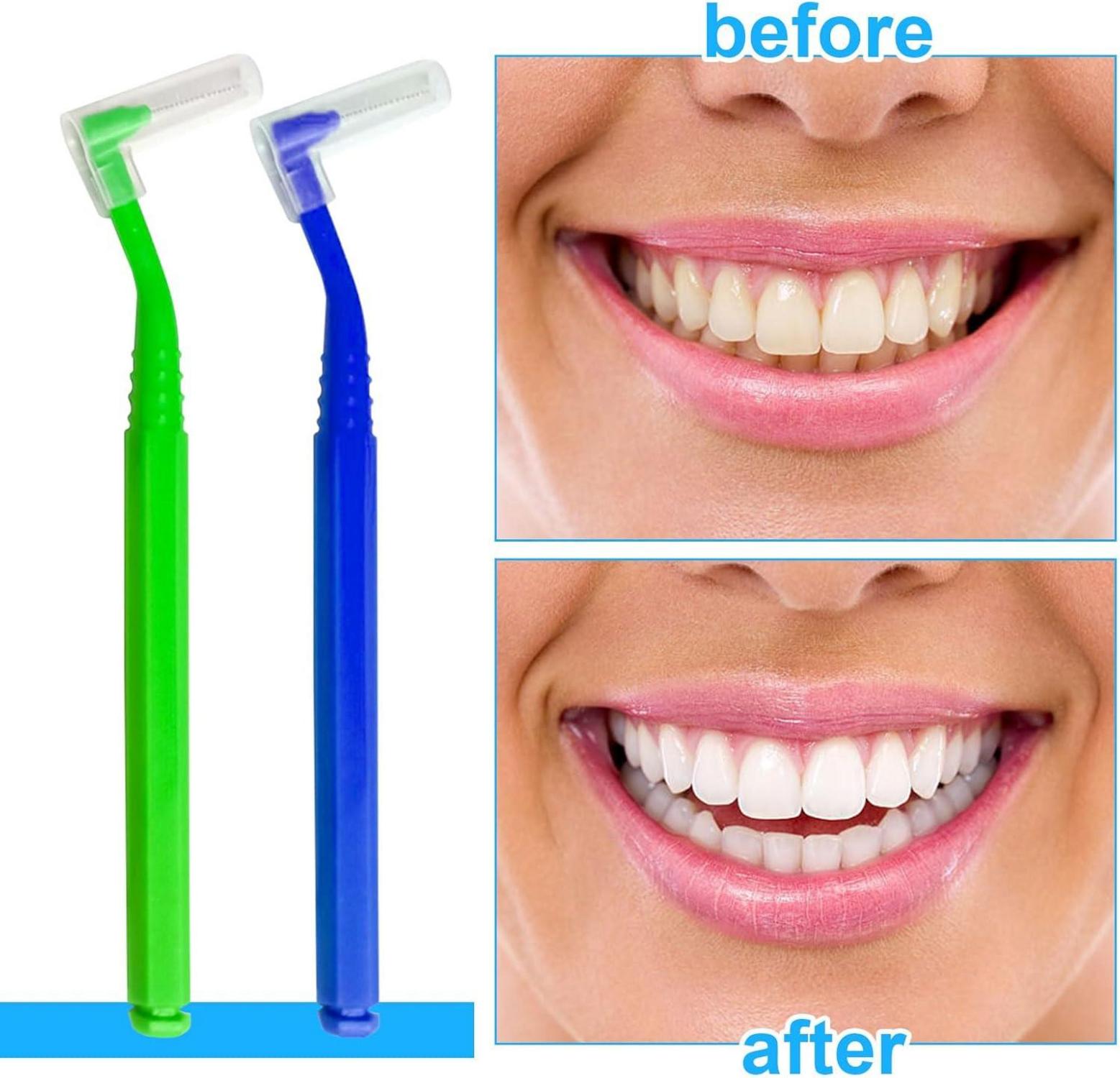 Interdentalbürsten 50 Stück L-förmig Zahnpflege 5 Farben