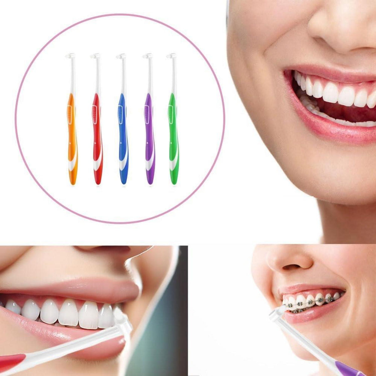 5er Set Getuftete Interdental-Zahnbürsten für Zahnspangen & Implantate