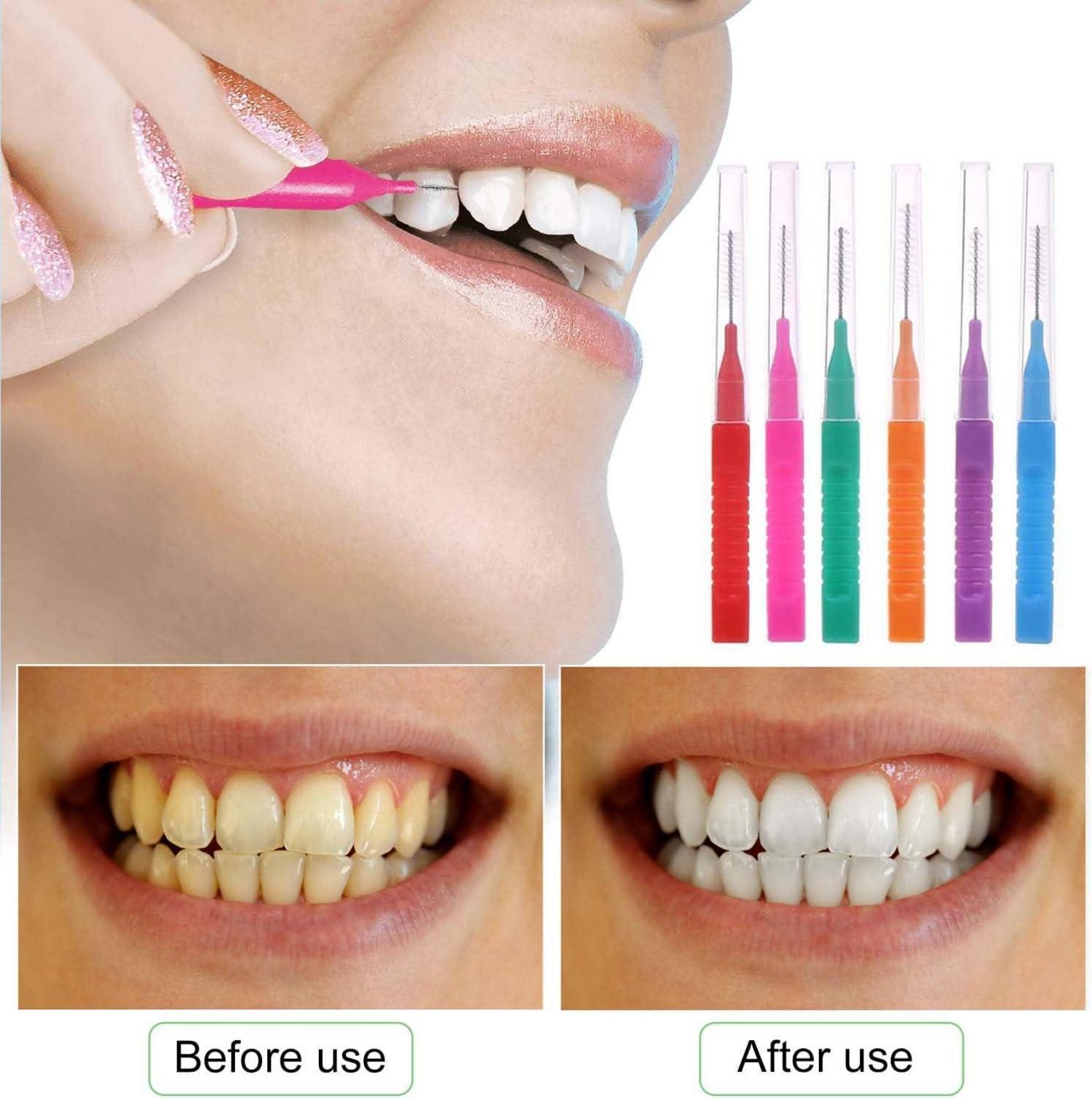 30er Pack Interdentalbürsten mit Etui und wiederverwendbarem Interdentalreiniger
