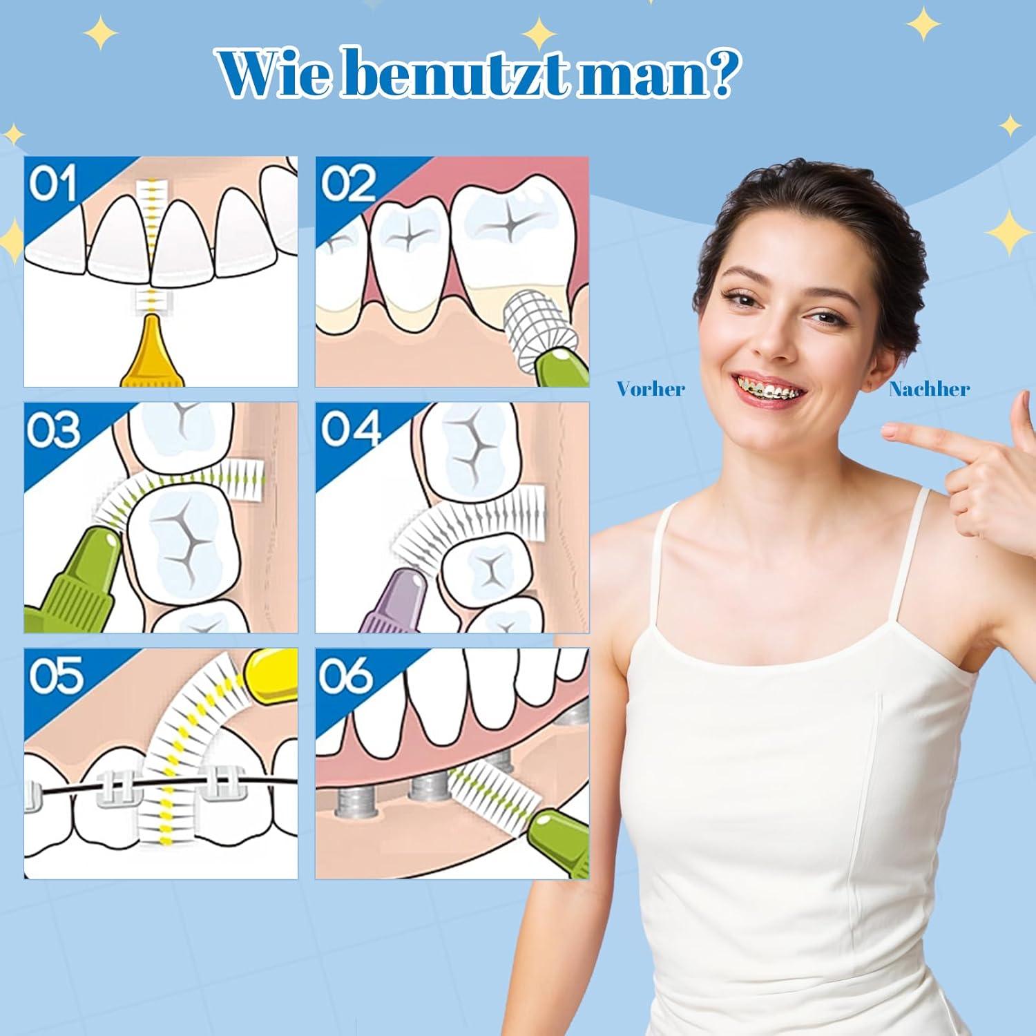 50 Stück Interdentalbürsten 5 Größen Rutschfester Griff Dentalbürsten Zahnreinigung Mundreinigung