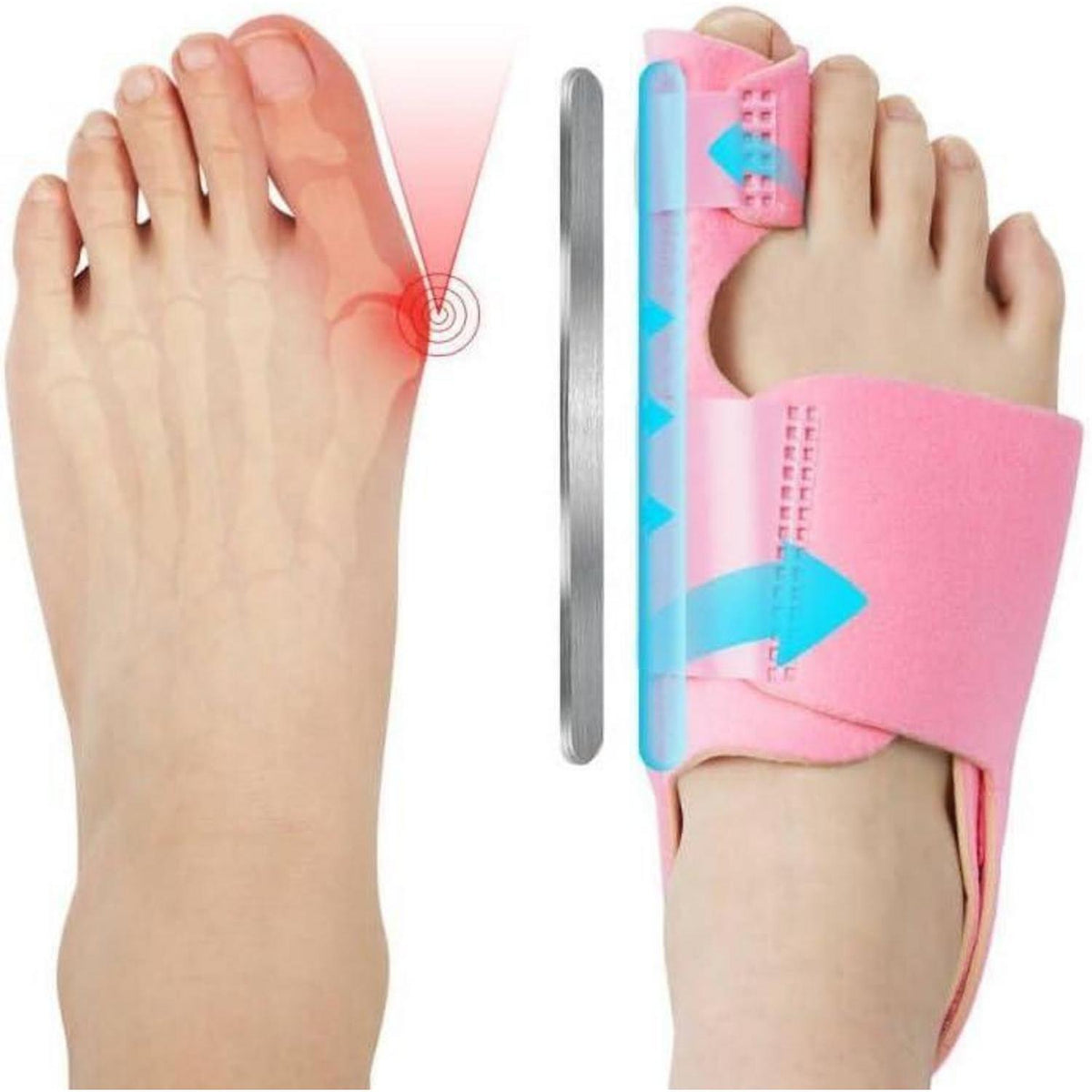 Hallux Valgus Korrektur Schiene mit Zehenspreizer, Rosa