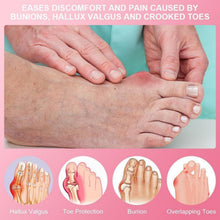 Hallux Valgus Korrektur Schiene mit Zehenspreizer, Rosa