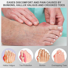 Hallux Valgus Korrektur Schiene mit Zehenspreizer - Grau